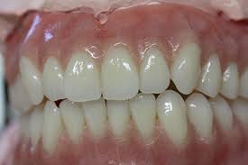 Spira Ολιστική Οδοντιατρική - Οδοντιατρείο Οδοντίατρος Θεσσαλονίκη - Οδοντοστοιχίες